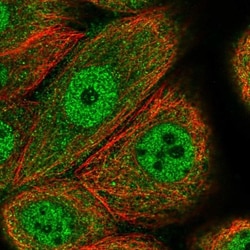 CCDC112 Antibody, Novus Biologicals 0.1mL; Unlabeled:Antibodies, Polyclonal
